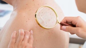 Read more about the article How to Take Care of Your Face to Get Flawless Skin