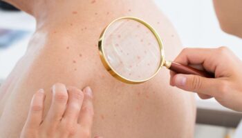 How to Take Care of Your Face to Get Flawless Skin
